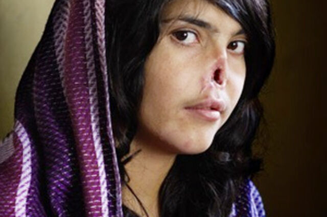 Retrato de uma mulher afeg&atilde; mutilada vence World Press Photo