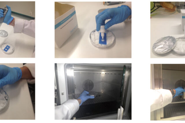 O kit que torna fluorescentes as bactérias más 