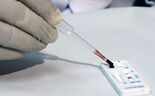 Depois da microcefalia, Zika pode estar relacionado com síndrome que causa paralisia