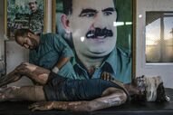 General News, first prize singles - Mauricio Lima, Brasil - IS Fighter Treated at Kurdish Hospital