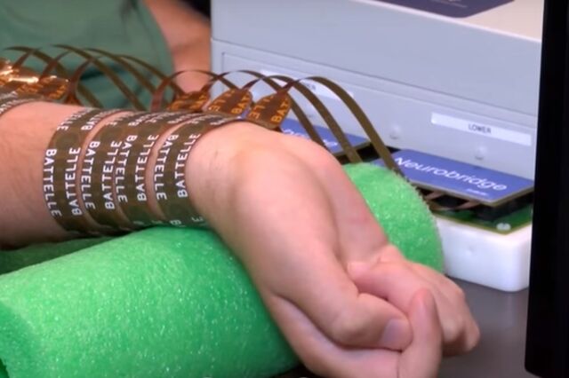 'Microchip' implantado no cérebro devolve parte da mobilidade a tetraplégico