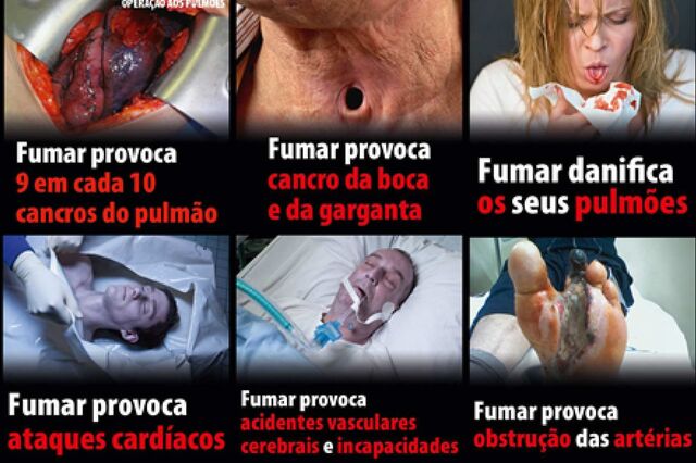 Imagens chocantes nos maços de tabaco