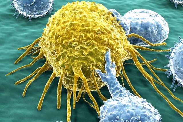 Microsoft declara guerra aberta ao cancro