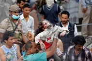 Um médico segura uma menina que foi resgatada dos escombros de uma casa em Sanaa, no Yemen, que foi destruída por um ataque aéreo conduzido pela Arábia Saudita.  