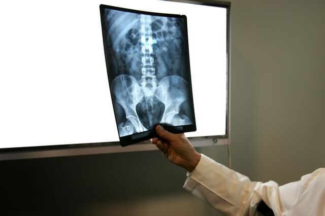 Médicos: 'O fundamental não ficou nada resolvido'