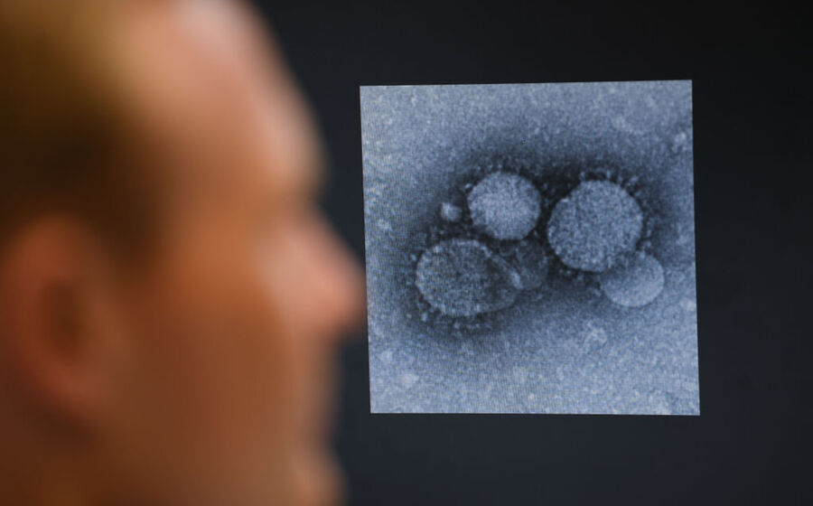 virus coronavirus 