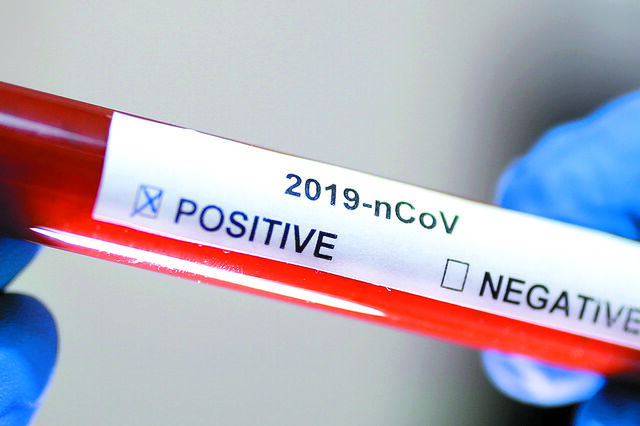Epidemia do Covid-19 põe travão à globalização