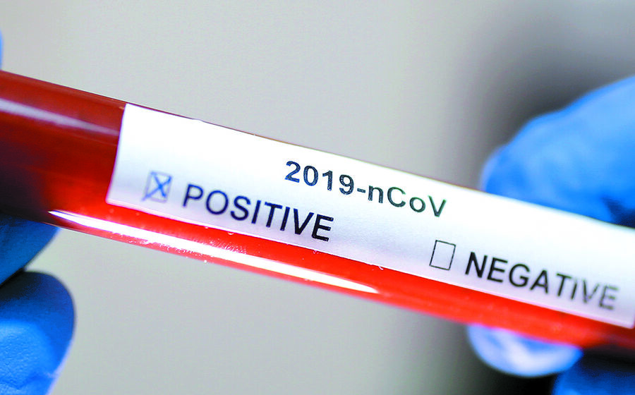 coronavirus covid-19