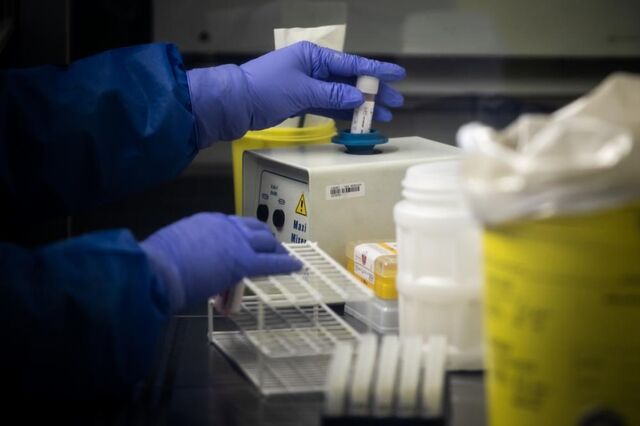 Covid-19: Variante britânica detetada em 58% das amostras do INSA em fevereiro