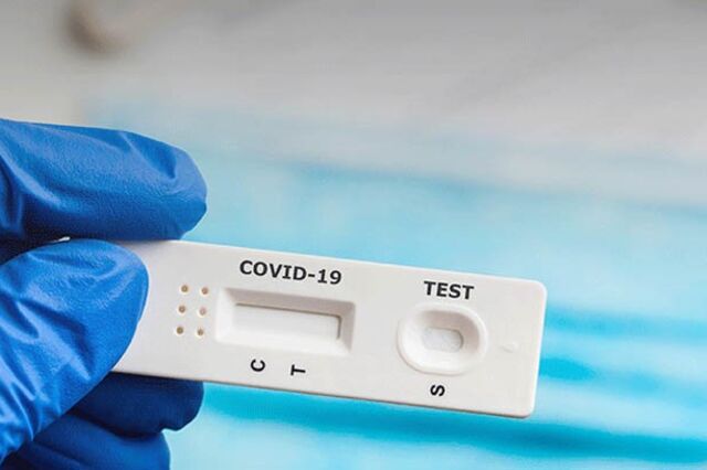 Comércio limita venda de autotestes após nova corrida