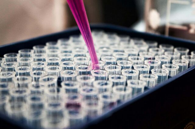 Portuguesa Lxbio quer levantar 10 milhões em nova ronda de financiamento