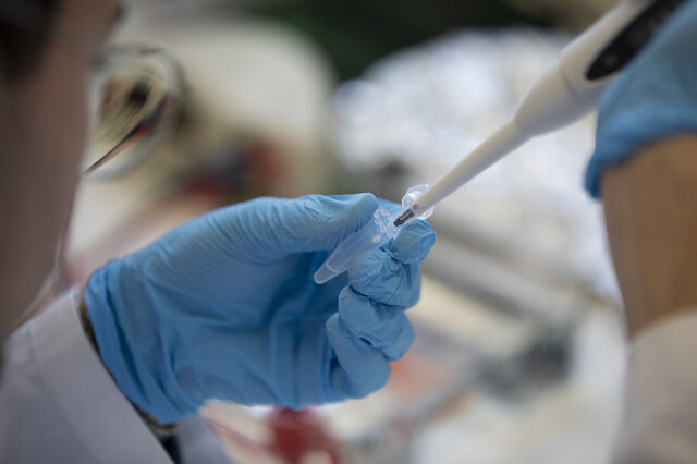 Gasto do Estado em análises clínicas interrompe queda e sobe 4% para 244 milhões em 2024