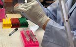 Trabalho laboratorial de análise ao hantavírus